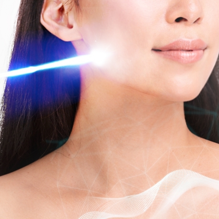 CO2 LASER_460x460