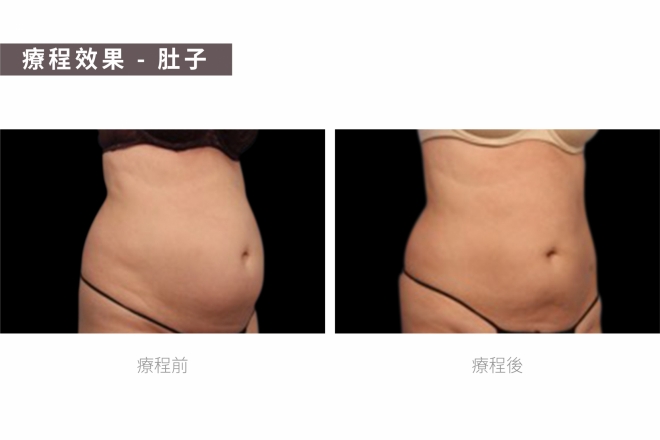 減肥纖體瘦身修身_TM圖-03