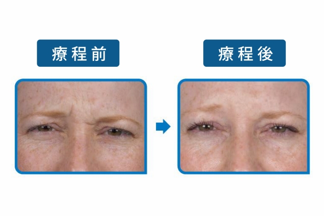TM圖_660x440-03