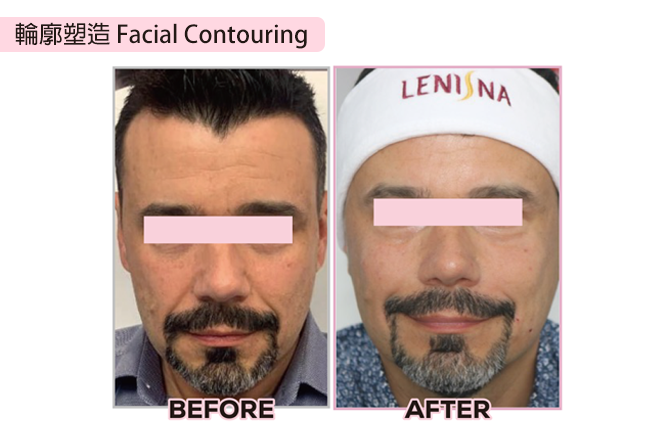 lenisna 4